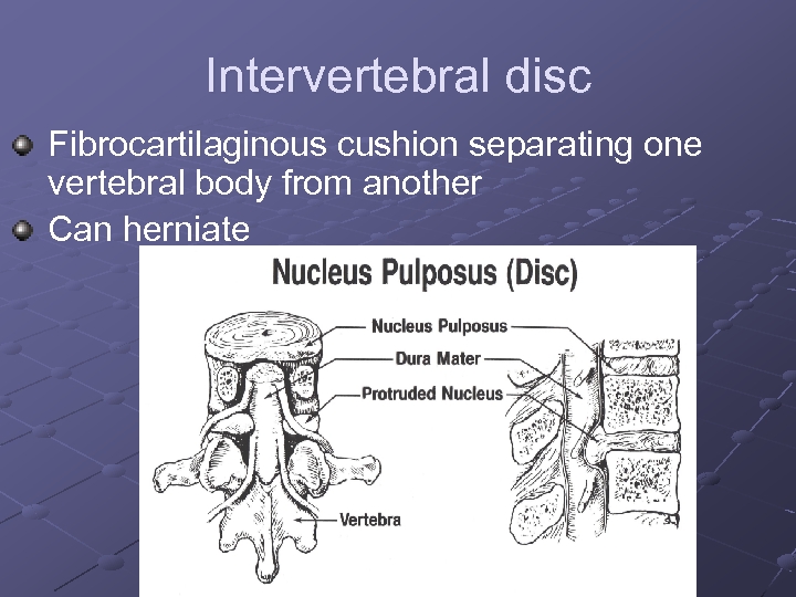 Intervertebral disc Fibrocartilaginous cushion separating one vertebral body from another Can herniate 