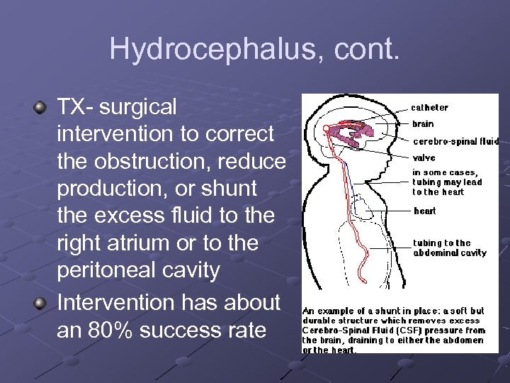Hydrocephalus, cont. TX- surgical intervention to correct the obstruction, reduce production, or shunt the