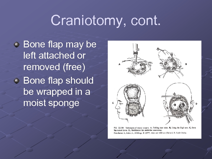 Craniotomy, cont. Bone flap may be left attached or removed (free) Bone flap should
