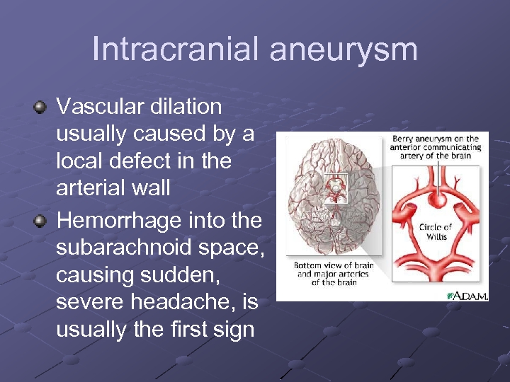 Intracranial aneurysm Vascular dilation usually caused by a local defect in the arterial wall