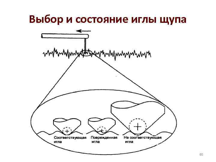 Выбор и состояние иглы щупа 65 