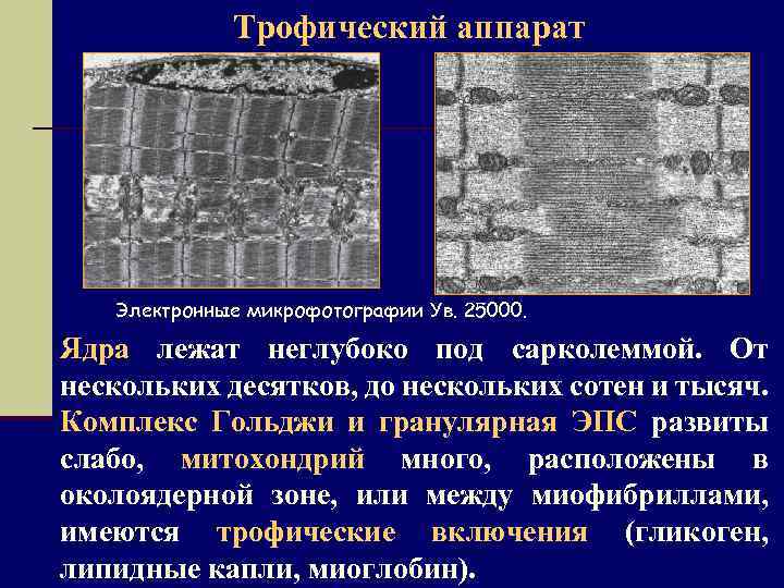 Трофический аппарат Электронные микрофотографии Ув. 25000. Ядра лежат неглубоко под сарколеммой. От нескольких десятков,