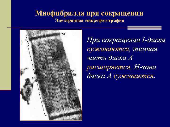 Миофибрилла при сокращении Электронная микрофотография При сокращении I-диски суживаются, темная часть диска А расширяется,