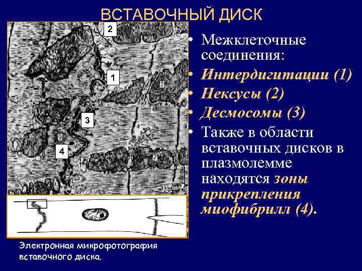 ВСТАВОЧНЫЙ ДИСК 2 1 3 4 Электронная микрофотография вставочного диска. • Межклеточные соединения: •