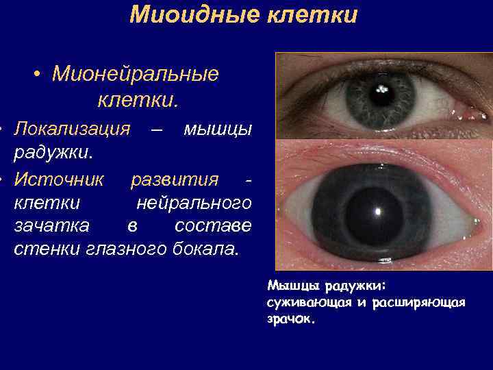 Миоидные клетки • Мионейральные клетки. • Локализация – мышцы радужки. • Источник развития -