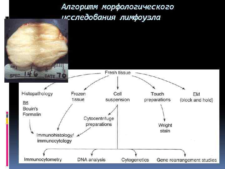 Алгоритм морфологического исследования лимфоузла 