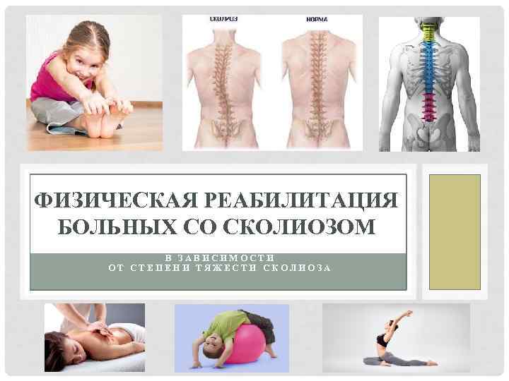 ФИЗИЧЕСКАЯ РЕАБИЛИТАЦИЯ БОЛЬНЫХ СО СКОЛИОЗОМ В ЗАВИСИМОСТИ ОТ СТЕПЕНИ ТЯЖЕСТИ СКОЛИОЗА 