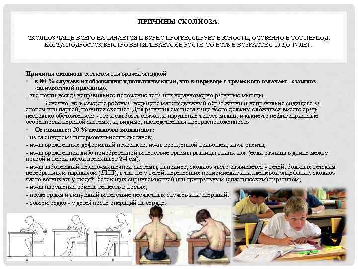 ПРИЧИНЫ СКОЛИОЗА. СКОЛИОЗ ЧАЩЕ ВСЕГО НАЧИНАЕТСЯ И БУРНО ПРОГРЕССИРУЕТ В ЮНОСТИ, ОСОБЕННО В ТОТ