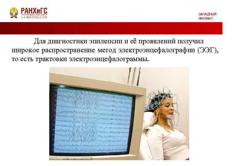 ЗАПАДНЫЙ ФИЛИАЛ Для диагностики эпилепсии и её проявлений получил широкое распространение метод электроэнцефалографии (ЭЭГ),