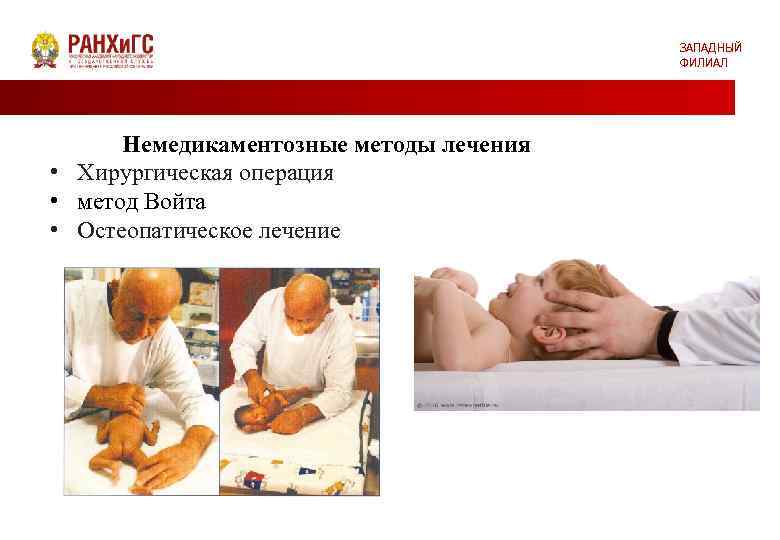 ЗАПАДНЫЙ ФИЛИАЛ Немедикаментозные методы лечения • Хирургическая операция • метод Войта • Остеопатическое лечение