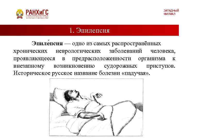 ЗАПАДНЫЙ ФИЛИАЛ 1. Эпилепсия Эпиле псия — одно из самых распространённых хронических неврологических заболеваний