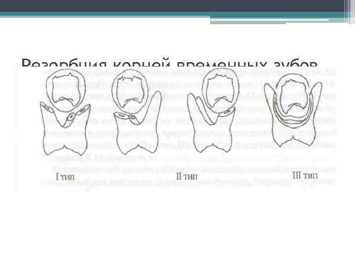 Резорбция корней временных зубов 
