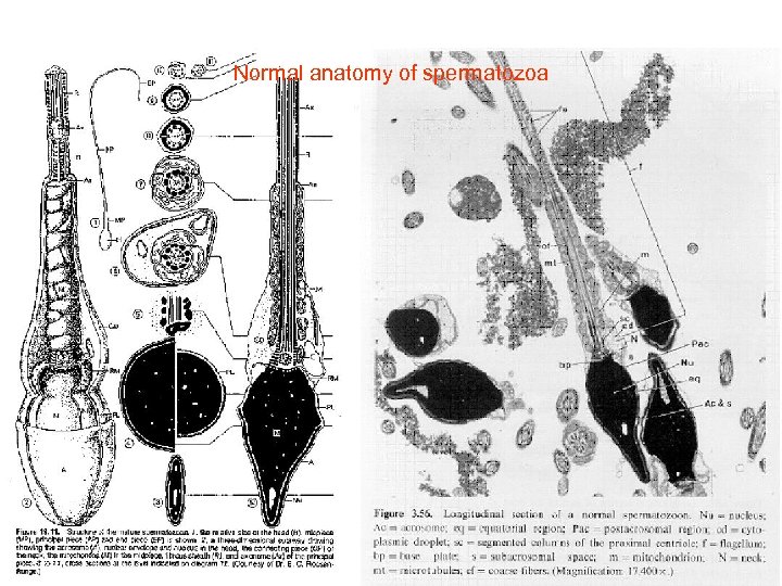Normal anatomy of spermatozoa 