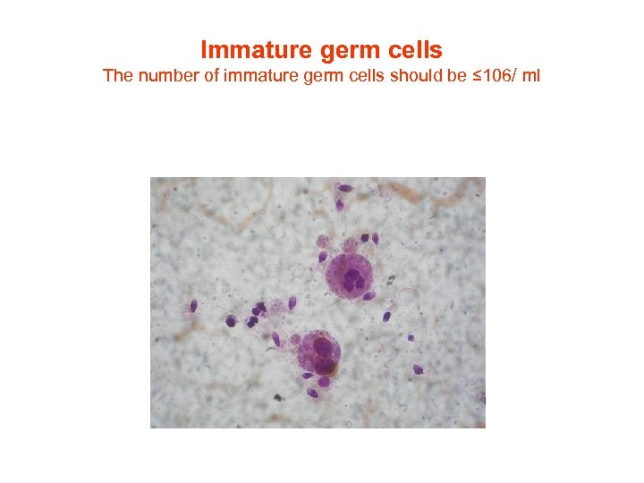 Immature germ cells The number of immature germ cells should be ≤ 106/ ml
