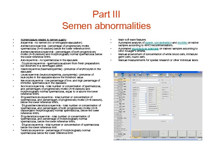 Part III Semen abnormalities • • • • Nomenclature related to semen quality Aspermia
