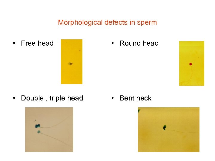 Morphological defects in sperm • Free head • Round head • Double , triple