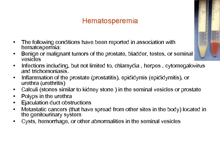 Hematosperemia • • • The following conditions have been reported in association with hematospermia: