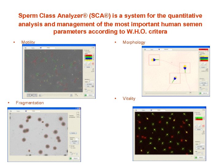  Sperm Class Analyzer® (SCA®) is a system for the quantitative analysis and management