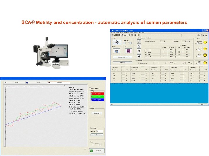 SCA® Motility and concentration - automatic analysis of semen parameters 