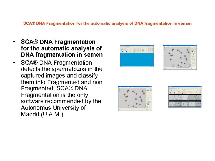 SCA® DNA Fragmentation for the automatic analysis of DNA fragmentation in semen • SCA®