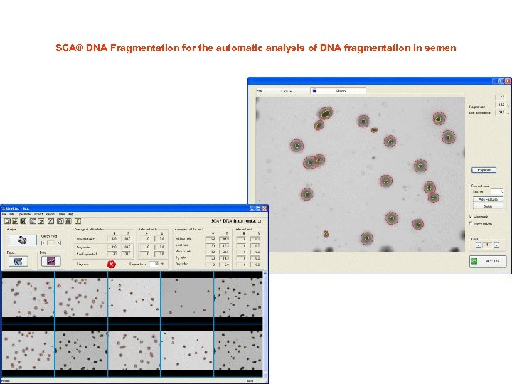 SCA® DNA Fragmentation for the automatic analysis of DNA fragmentation in semen 