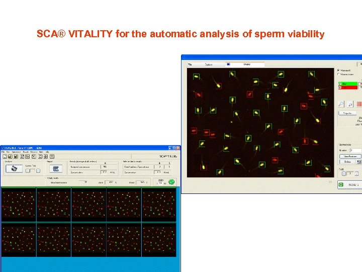 SCA® VITALITY for the automatic analysis of sperm viability 