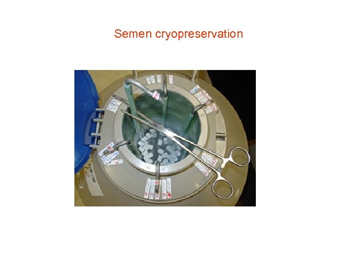 Semen cryopreservation 