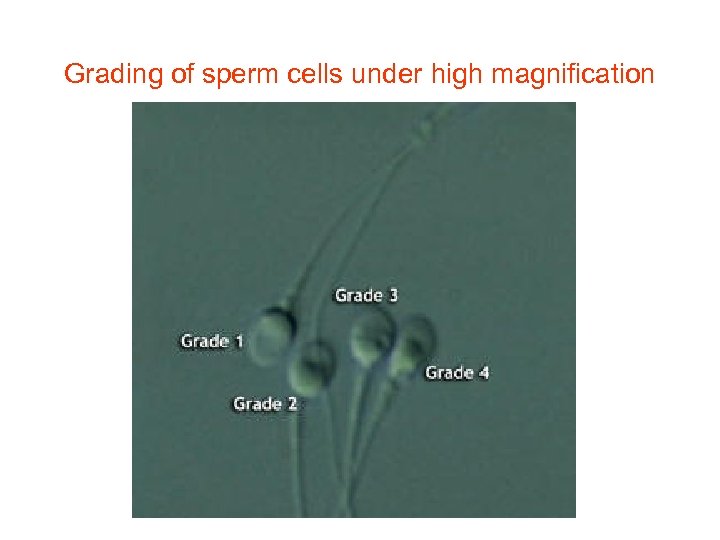 Grading of sperm cells under high magnification 