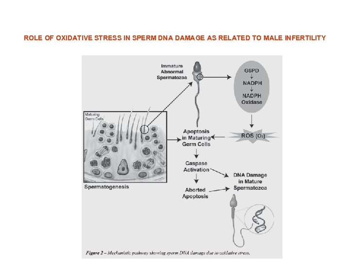ROLE OF OXIDATIVE STRESS IN SPERM DNA DAMAGE AS RELATED TO MALE INFERTILITY 