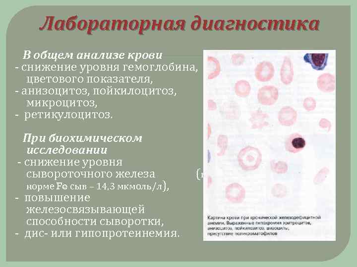 Анизоцитоз в общем анализе крови. Анизоцитоз и пойкилоцитоз в крови. Микроцитоз анизоцитоз пойкилоцитоз. Микроциты пойкилоцитоз. Пойкилоцитоз и макроцитоз.