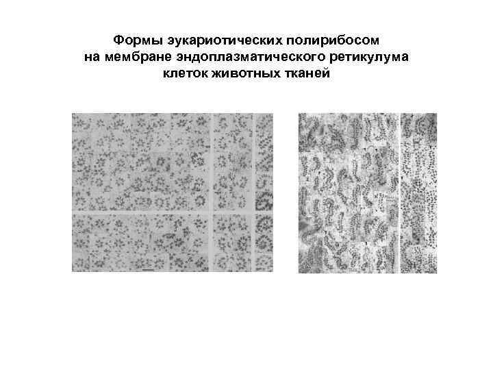 Формы эукариотических полирибосом на мембране эндоплазматического ретикулума клеток животных тканей 