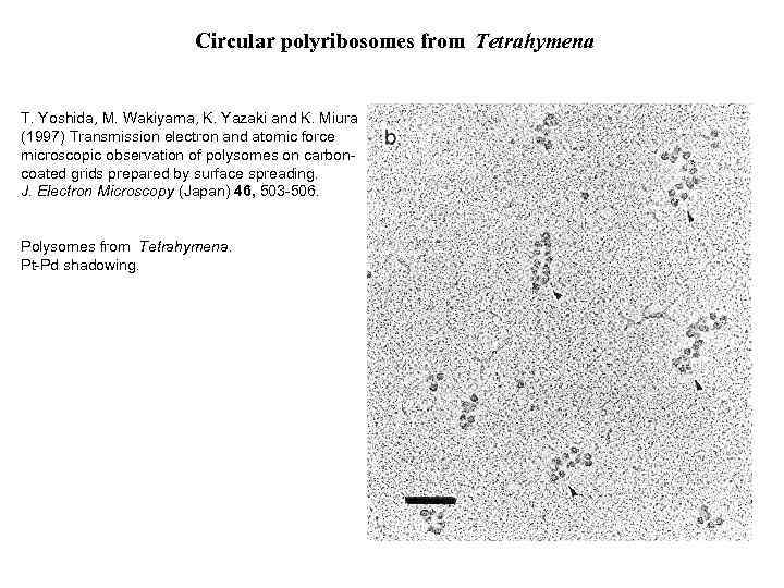 Circular polyribosomes from Tetrahymena T. Yoshida, M. Wakiyama, K. Yazaki and K. Miura (1997)