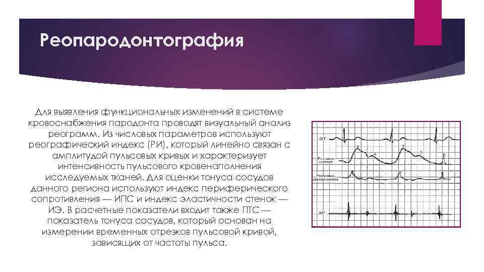 Реопародонтография Для выявления функциональных изменений в системе кровоснабжения пародонта проводят визуальный анализ реограмм. Из