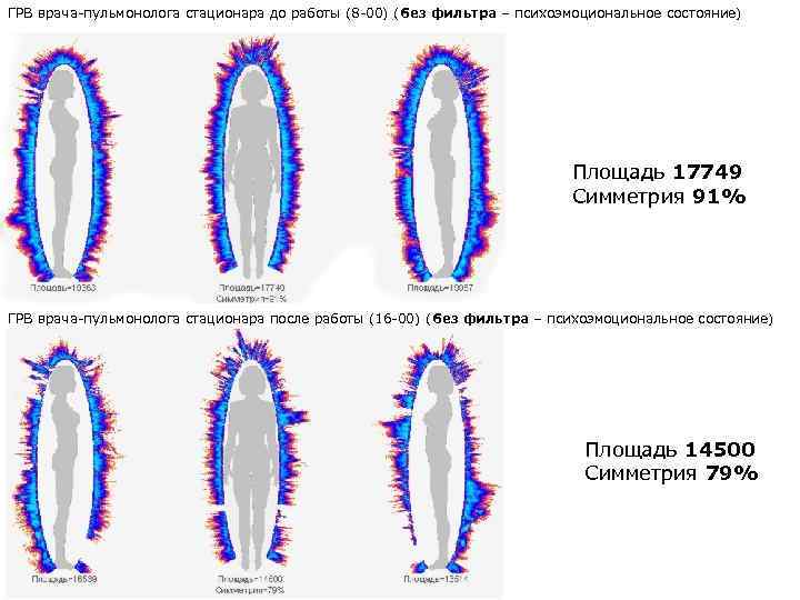 ГРВ врача-пульмонолога стационара до работы (8 -00) (без фильтра – психоэмоциональное состояние) Площадь 17749