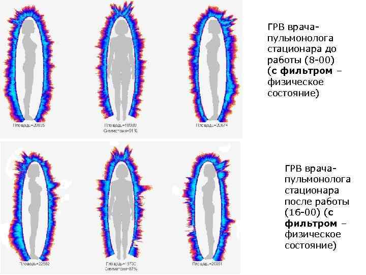 ГРВ врачапульмонолога стационара до работы (8 -00) (с фильтром – физическое состояние) ГРВ врачапульмонолога