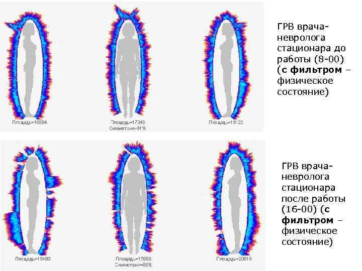 ГРВ врачаневролога стационара до работы (8 -00) (с фильтром – физическое состояние) ГРВ врачаневролога