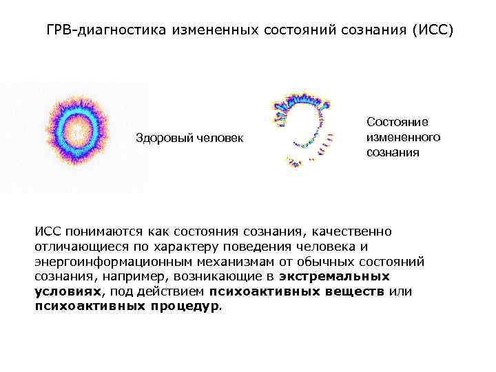 ГРВ-диагностика измененных состояний сознания (ИСС) Здоровый человек Состояние измененного сознания ИСС понимаются как состояния