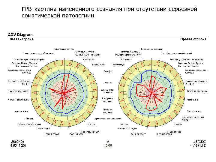 ГРВ-картина измененного сознания при отсутствии серьезной соматической патологиии 