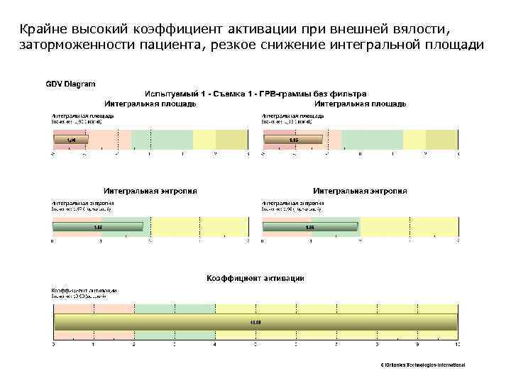 Крайне высокий коэффициент активации при внешней вялости, заторможенности пациента, резкое снижение интегральной площади 