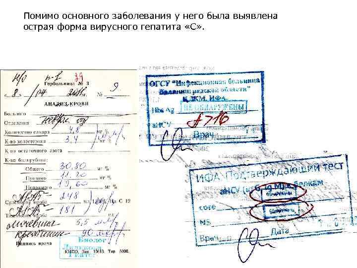 Помимо основного заболевания у него была выявлена острая форма вирусного гепатита «С» . 