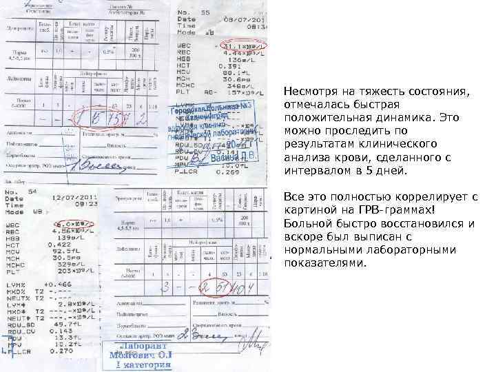 Несмотря на тяжесть состояния, отмечалась быстрая положительная динамика. Это можно проследить по результатам клинического