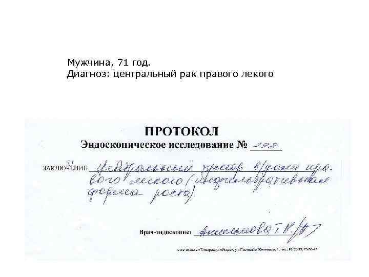 Мужчина, 71 год. Диагноз: центральный рак правого лекого 