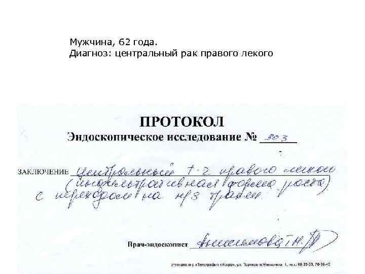 Мужчина, 62 года. Диагноз: центральный рак правого лекого 