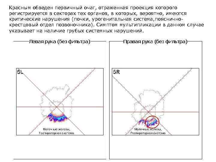 Красным обведен первичный очаг, отраженная проекция которого регистрируется в секторах тех органов, в которых,
