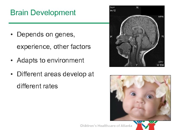 Brain Development • Depends on genes, experience, other factors • Adapts to environment •