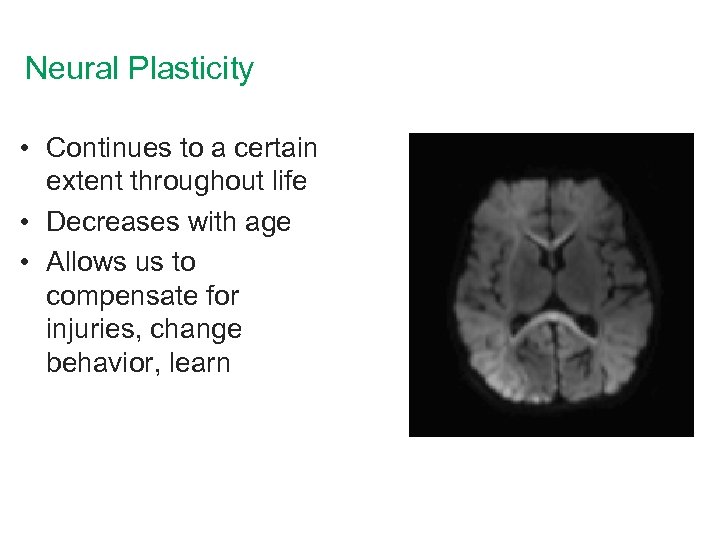 Neural Plasticity • Continues to a certain extent throughout life • Decreases with age