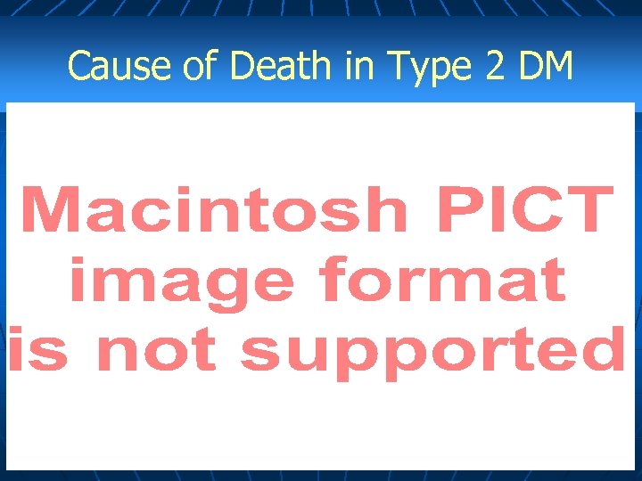 Cause of Death in Type 2 DM 