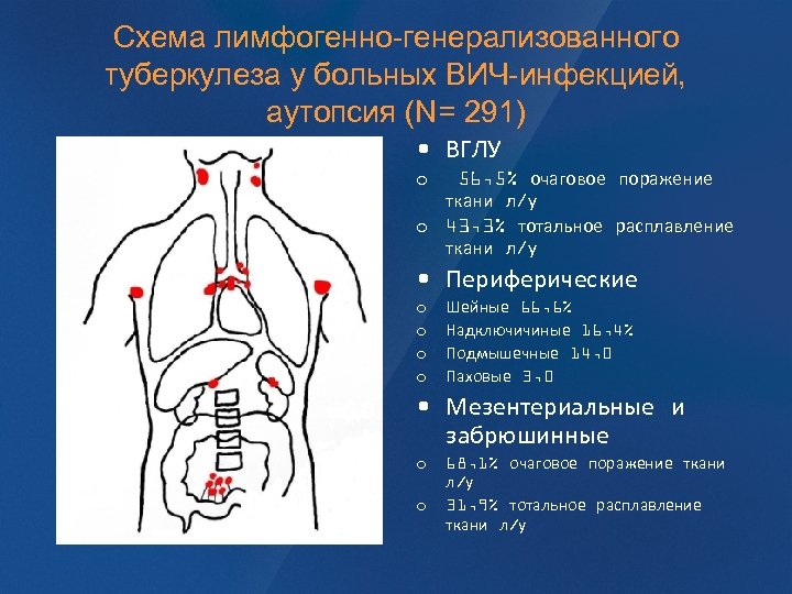 Схема лимфогенно-генерализованного туберкулеза у больных ВИЧ-инфекцией, аутопсия (N= 291) • ВГЛУ 56, 5% очаговое
