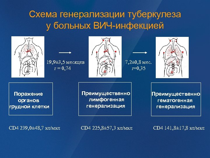 Схема генерализации туберкулеза у больных ВИЧ-инфекцией 19, 9± 3, 5 месяцев r = 0,