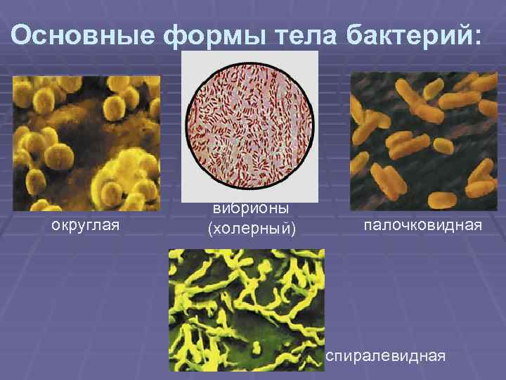 Основные формы тела бактерий: округлая вибрионы (холерный) палочковидная спиралевидная 